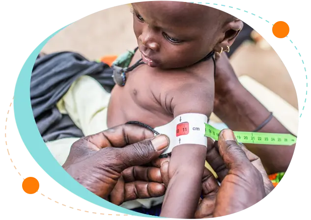 Best treatment for child nutritional disorders in Bangladesh