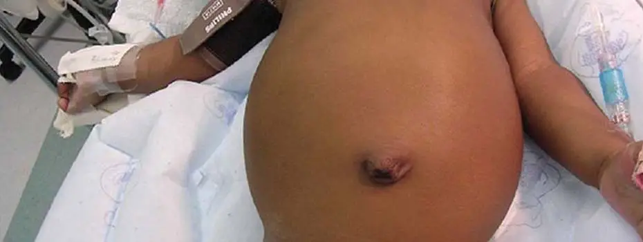শিশু গ্যাস্ট্রো-লিভার বিশেষজ্ঞ ডাক্তার
