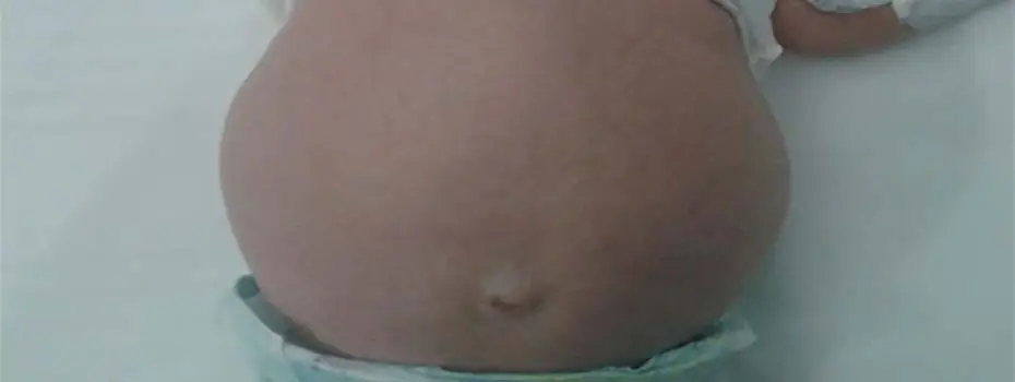 শিশু গ্যাস্ট্রো-লিভার বিশেষজ্ঞ ডাক্তার