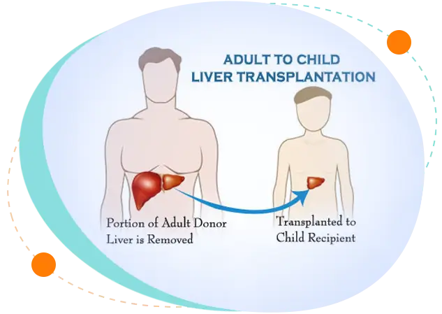 Child liver biopsy procedure in Bangladesh