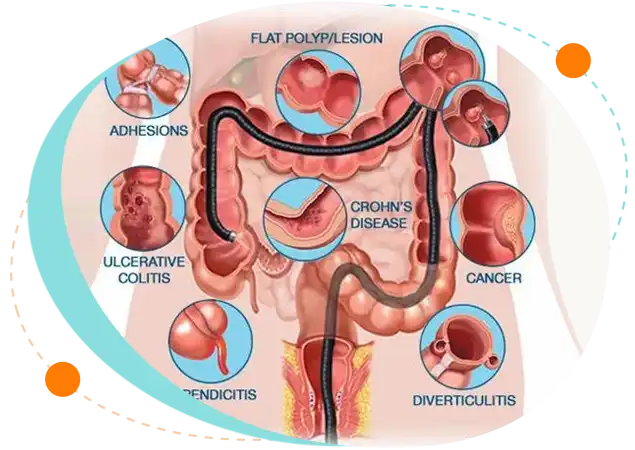 Colonoscopy test price/cost in Bangladesh
