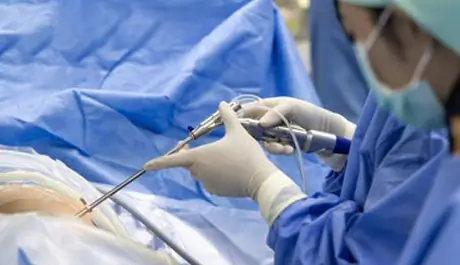 Endoscopic Band
                                            Ligation