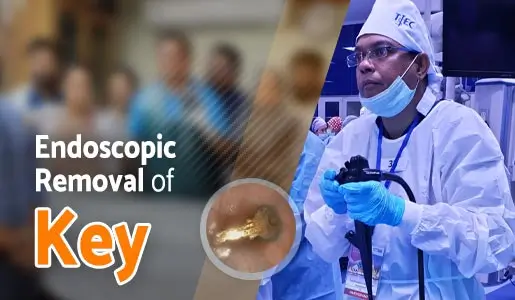 Endoscopic Key Removal - 2