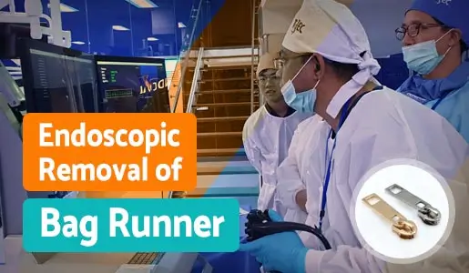 Endoscopic Removal of Bag Runner video thumb 