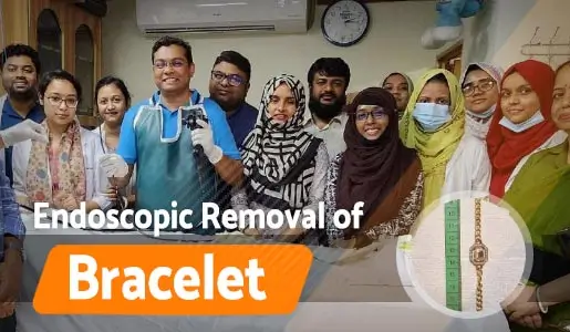 Endoscopic Removal of Bracelet
