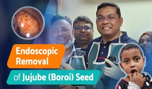 Endoscopic Removal of Jujube (Boroi) Seed 