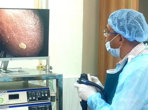 Endoscopic Sclerotherapy