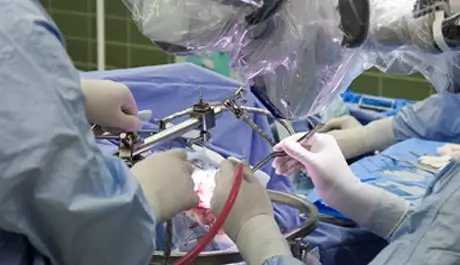 Endoscopic
                                            Sclerotherapy