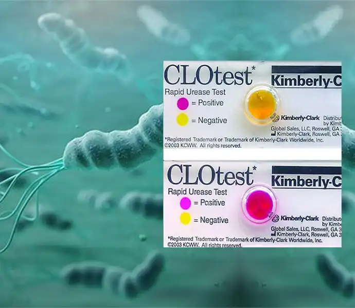 Laboratory testing for H. pylori isolation