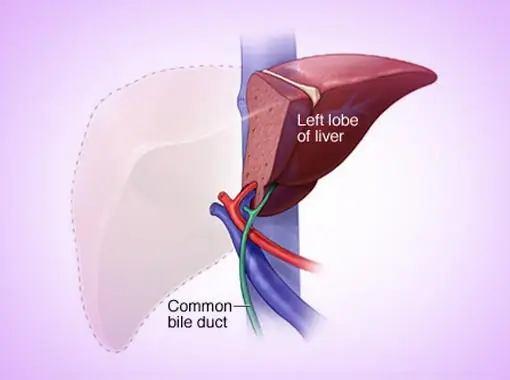 Liver Biopsy