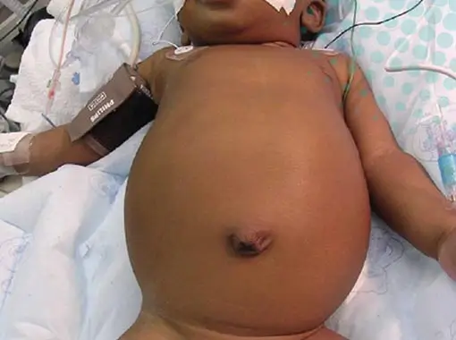 Pediatric Gastroenterology