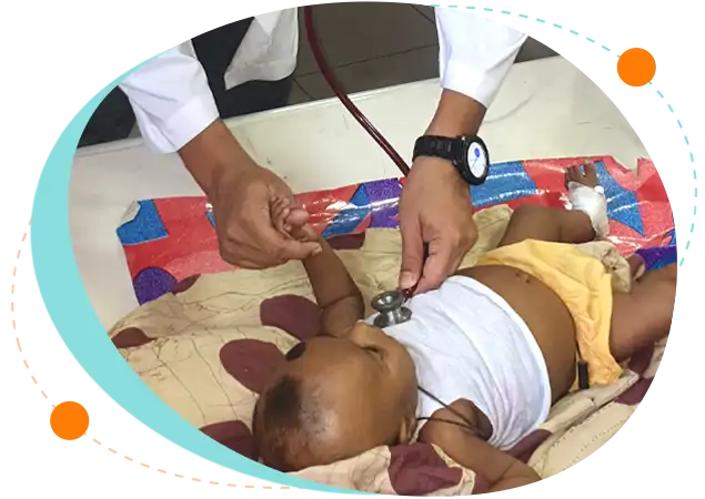 Severe acute malnutrition treatment children