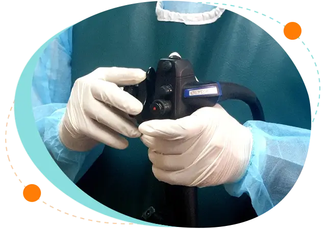 Step by step process of colonoscopic polypectomy