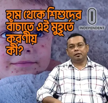 হাম থেকে শিশুদের বাঁচাতে করণীয়
